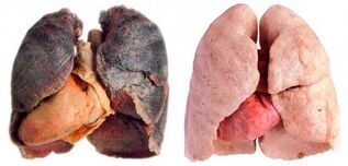 kadilska pljuča in zdrava